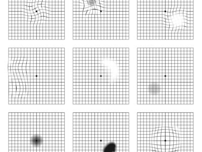 Amsler grid scotoma eye test. Oculist Vector printable chart retina examination. Grid with dot in centre. Vision control.